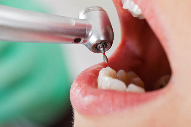 Best Urgent Dental Care for Toothaches in Brooktrails, CA